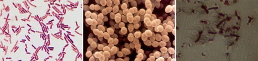 Echerichika coli, fecal enococcccus a Protei sinn d'Haapt causative Agenten vu chronescher Bakteriatitis