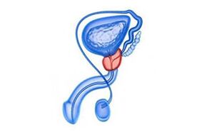 Zeechnen vun Prostata Entzündung